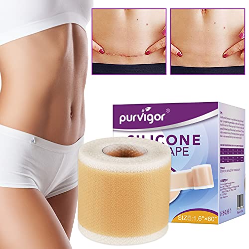 Silicone Scar Tape Roll, 1.6” x 60” Medical Tape for Wound Care Bandages  Scars Strips for Surgical Scars Keloid, C-Section, Burns, Injuries Acne,  Stretch Marks Removal Sheet Tapes