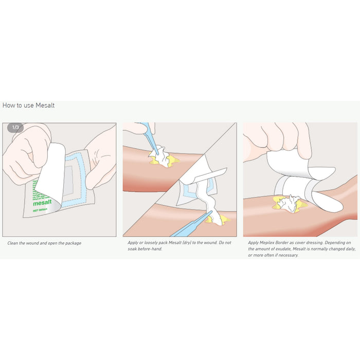 Wound Care>Wound Dressings>Impregnated Dressings - McKesson - Wasatch Medical Supply