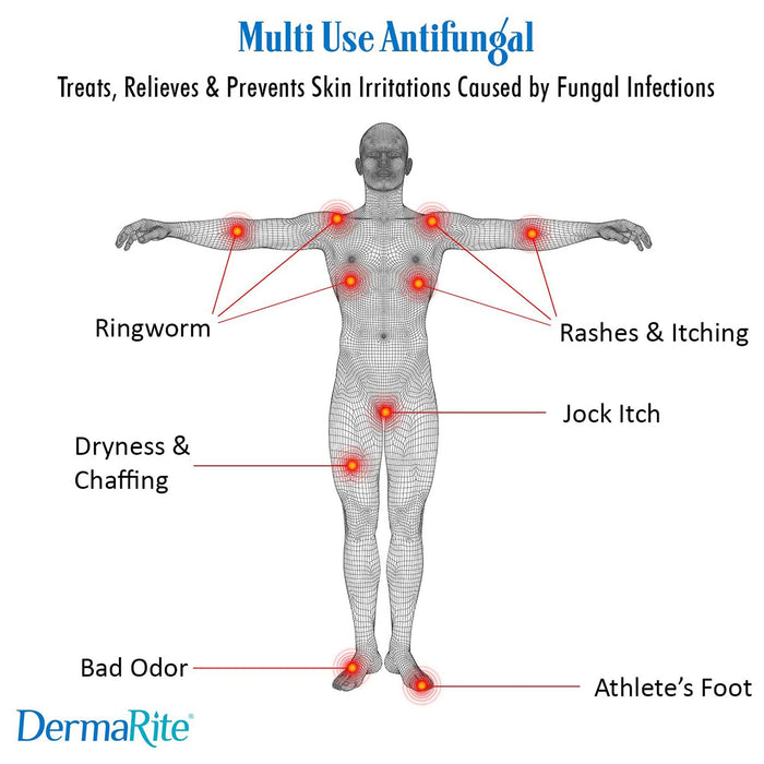 Health & Medicine>Anti-Itch & Antifungals - McKesson - Wasatch Medical Supply