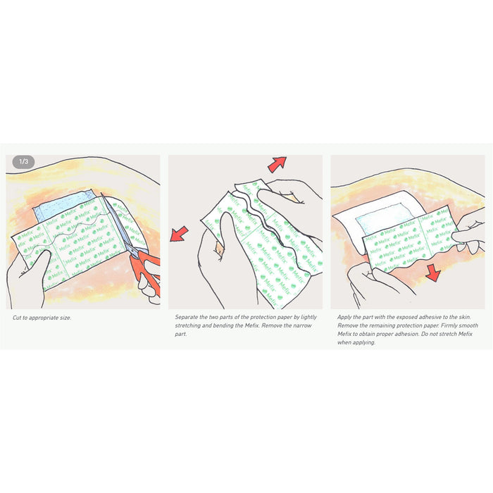 Wound Care>Tapes & Accessories>Cloth Tapes - McKesson - Wasatch Medical Supply