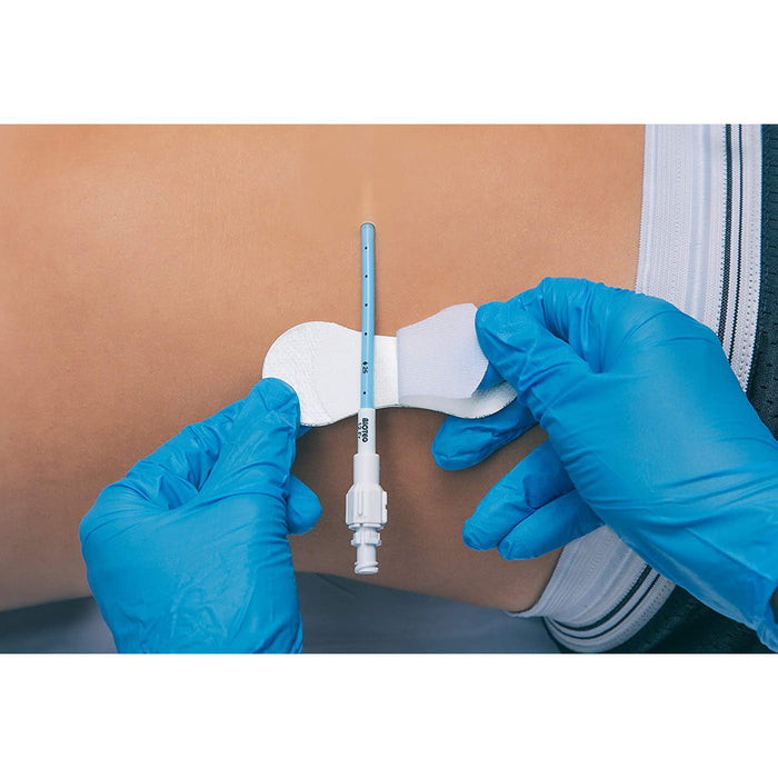 Lab & Scientific Supplies>Clinical Laboratory Accessories - McKesson - Wasatch Medical Supply