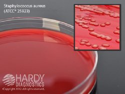 Hardy Diagnostics Tryptic Soy Agar (TSA) with 5% Sheep Blood Prepared Media