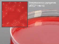 Hardy Diagnostics Selective Strep Agar (COBA Medium) Prepared Media