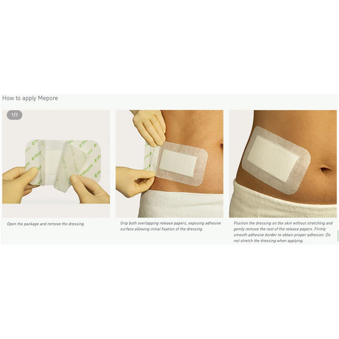 Wound Care>Gauze>Island Dressings - McKesson - Wasatch Medical Supply